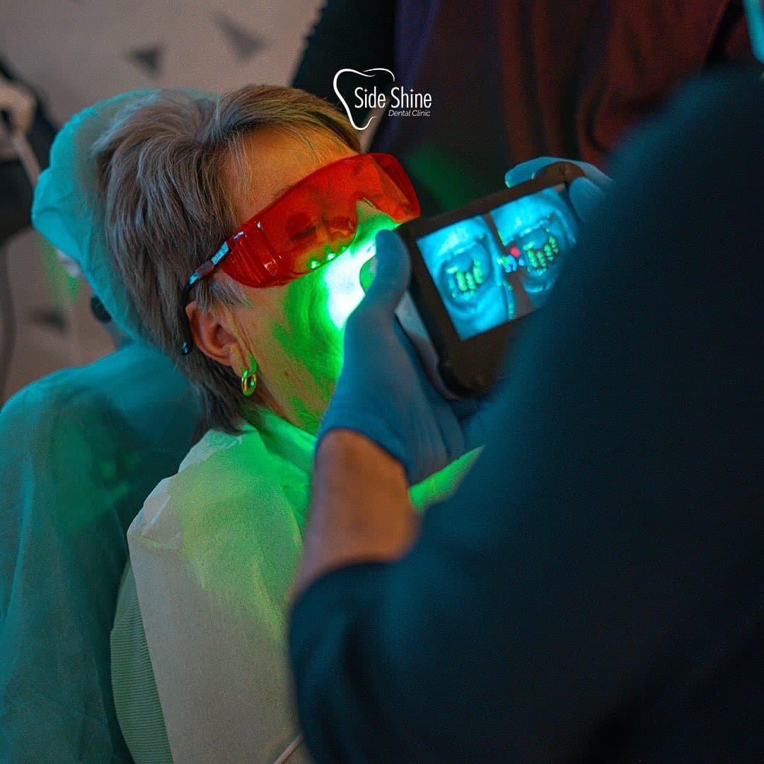 Side Shine Galerie Foto 18