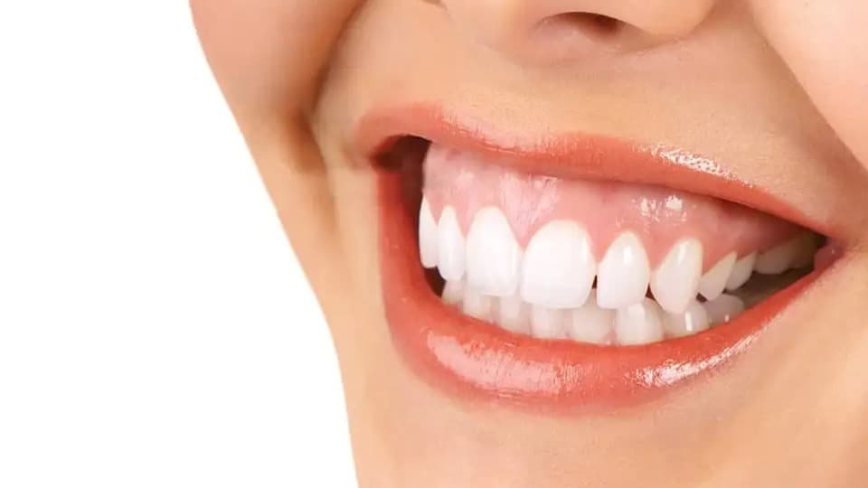 Pembe Estetik (Gummy Smile)